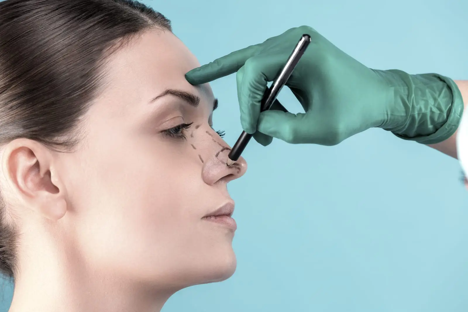 A gloved hand holding a surgical marker draws a planning line along the bridge of a woman's nose, seen from the side.