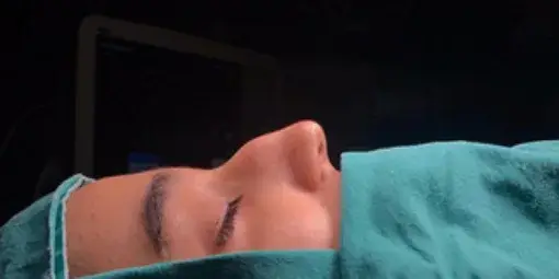 Case 1, the nose in profile before the operation.