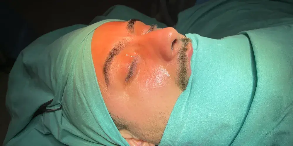 Case 1, the nose in profile before the operation.