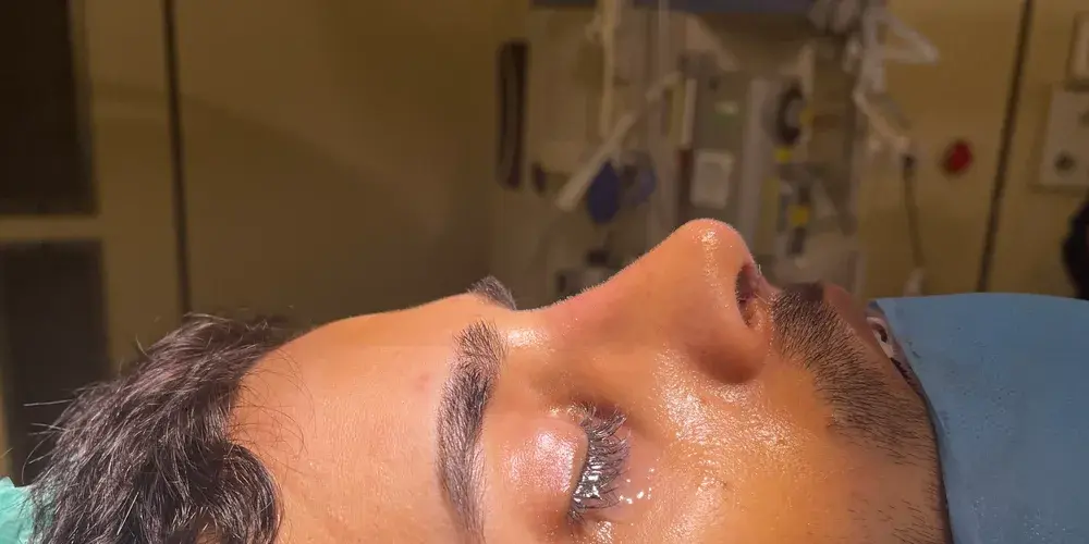 Case 3, the same nose at the end of the operation.
