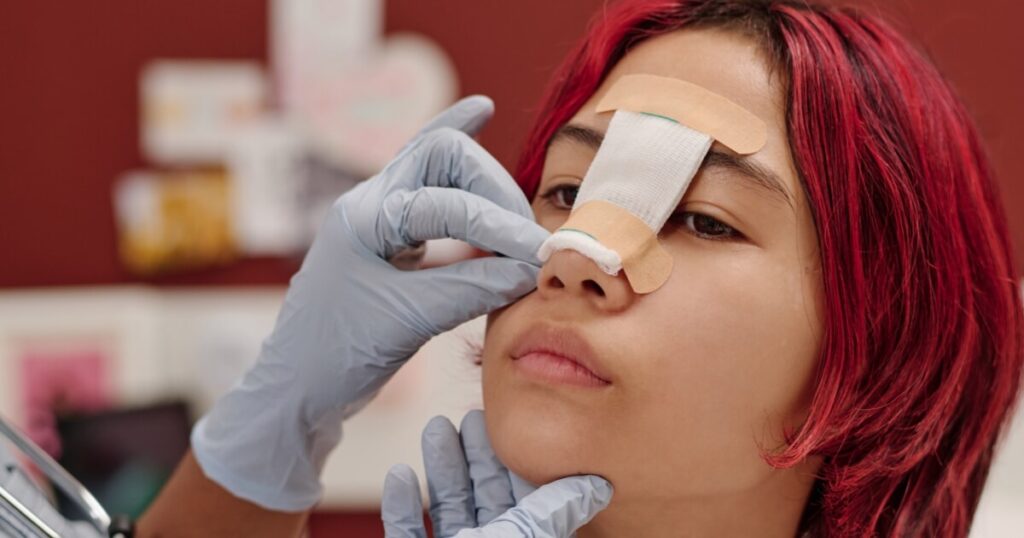 A doctor is making a revision rhinoplasty for a woman. Taking off her bandages.