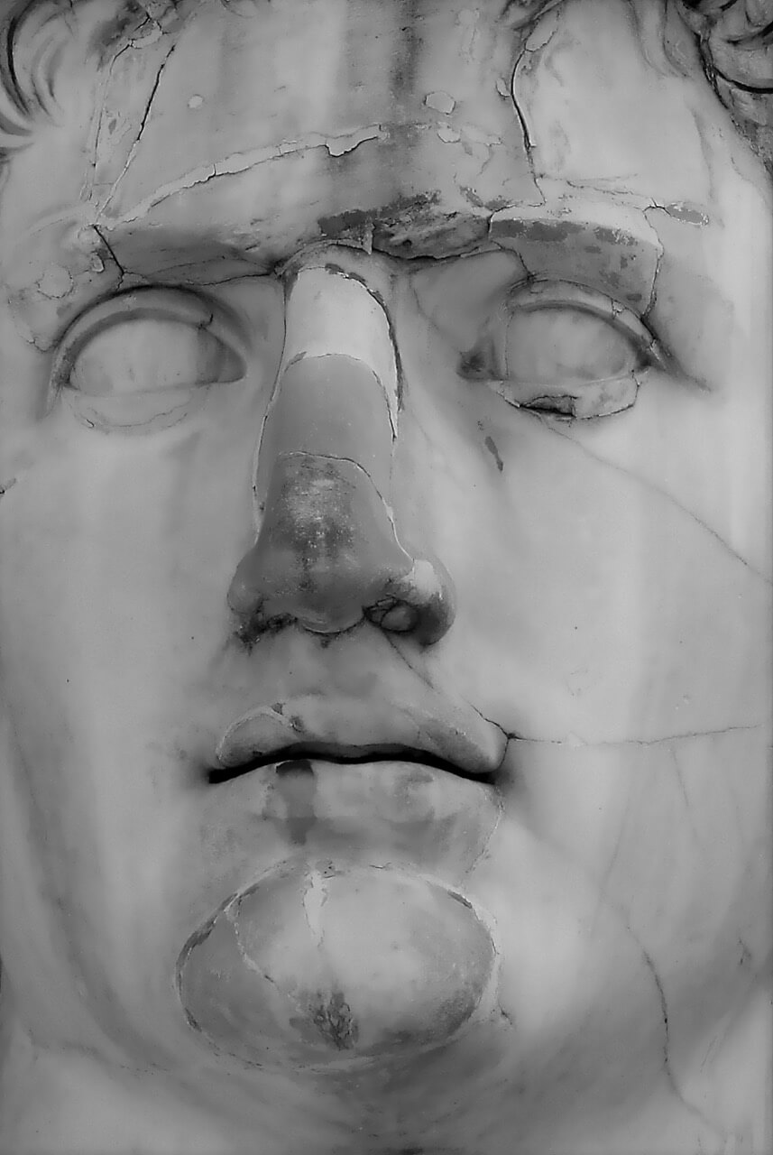 A cracked statue from ancient times that implies rhinoplasty techniques.